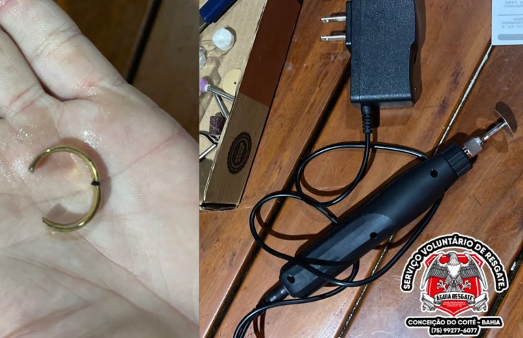 Homem procura Águia Resgate para remover anel preso no dedo e situação vira momento de humor em Conceição do Coité