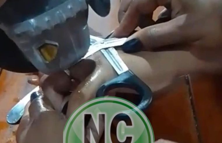 Após ver divulgação no Instagram, homem procura Águia Resgate para retirar anel preso no dedo em Conceição do Coité; veja o vídeo da retirada