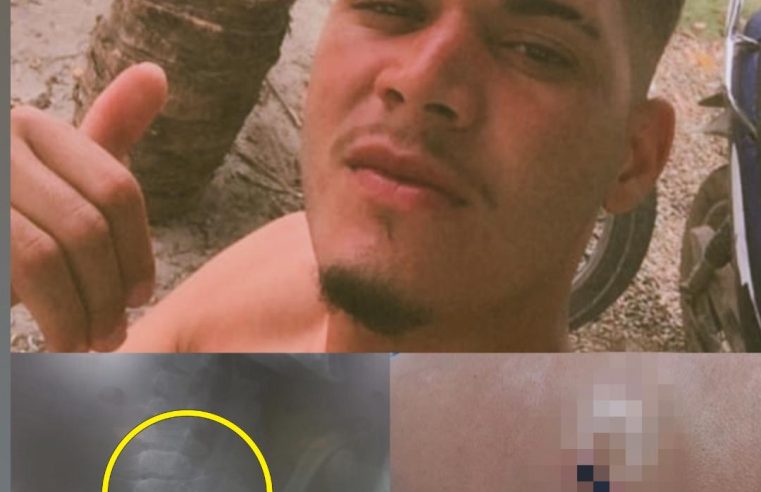 “Levei o tiro e segui com medo de parar”: jovem baleado nas costas detalha momento do disparo e questiona abordagem da PRE na BA-409, em Conceição do Coité