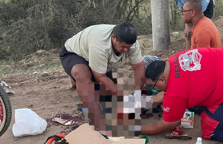 Mulher sofre fratura exposta após colisão entre motocicletas na BA-409, em Conceição do Coité