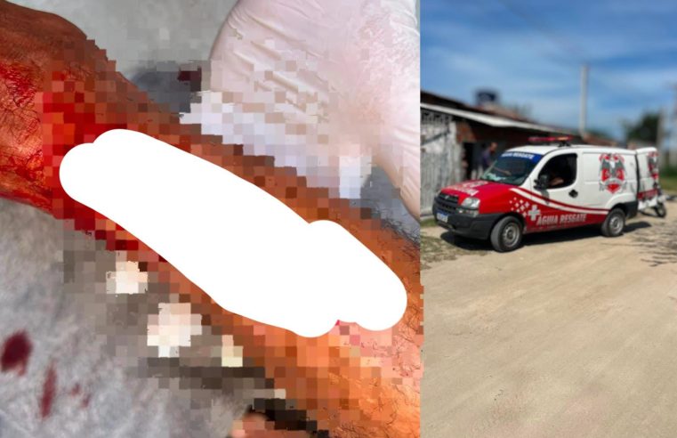 Homem sofre profundo corte na perna após disco de makita se romper enquanto amolava enxada em Conceição do Coité