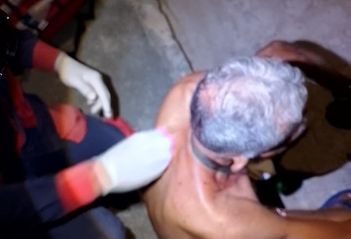 Discussão entre vizinhos termina com homem ferido a pedradas em Conceição do Coité